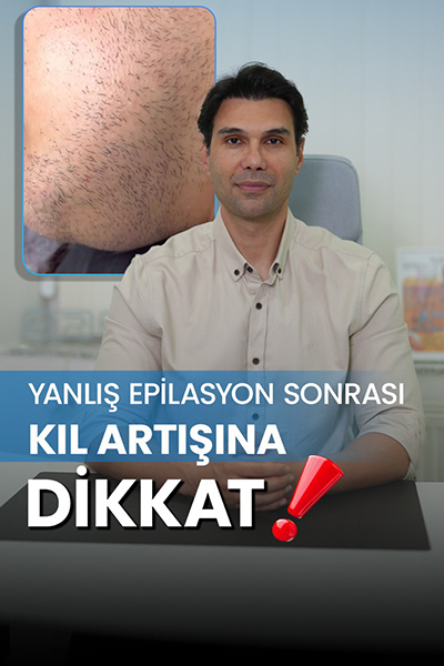 Mr. Falcon Beauty Sıkça Sorulan Sorular