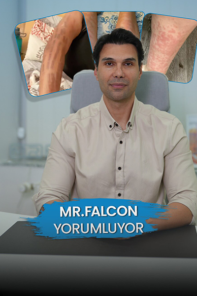 Mr. Falcon Beauty Sıkça Sorulan Sorular